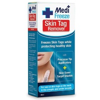 Medi Freeze Skin Tag Remover 38ML ensure targetted treatment